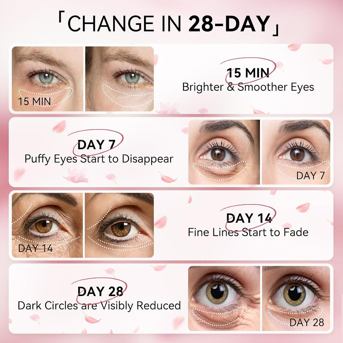 Parche Ojos Flamingo Lumina
