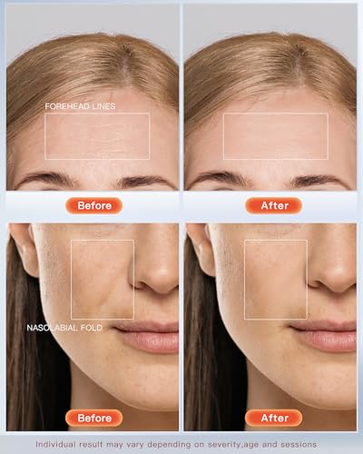 Mascarilla LED Facial Glow