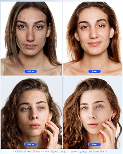 Mascarilla LED Facial Glow